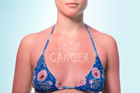 sunburned woman with skin cancer written on her